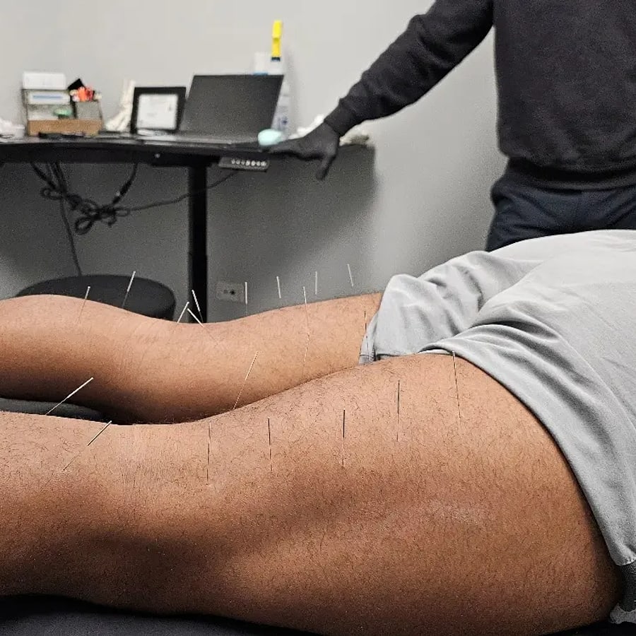 Treatment for Plantar Fasciitis at Action Chiropractic and Sports Injury Center