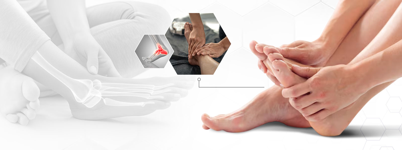 Foot care montage: X-ray of foot bones, hands massaging an ankle, and resting feet.
